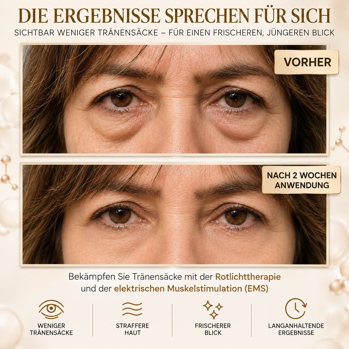 Regard Lift™ – Gerät gegen Augenringe & Tränensäcke